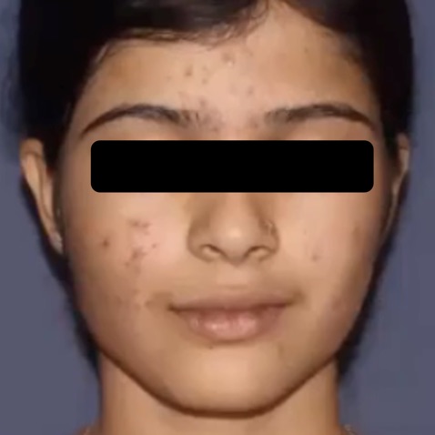 Before & Afters - Courtesy of Swapnil Shah, MD