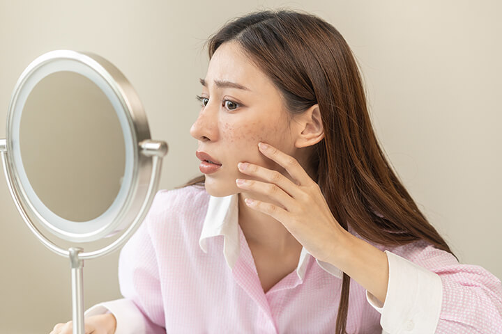Asian woman looking at her acne in mirror