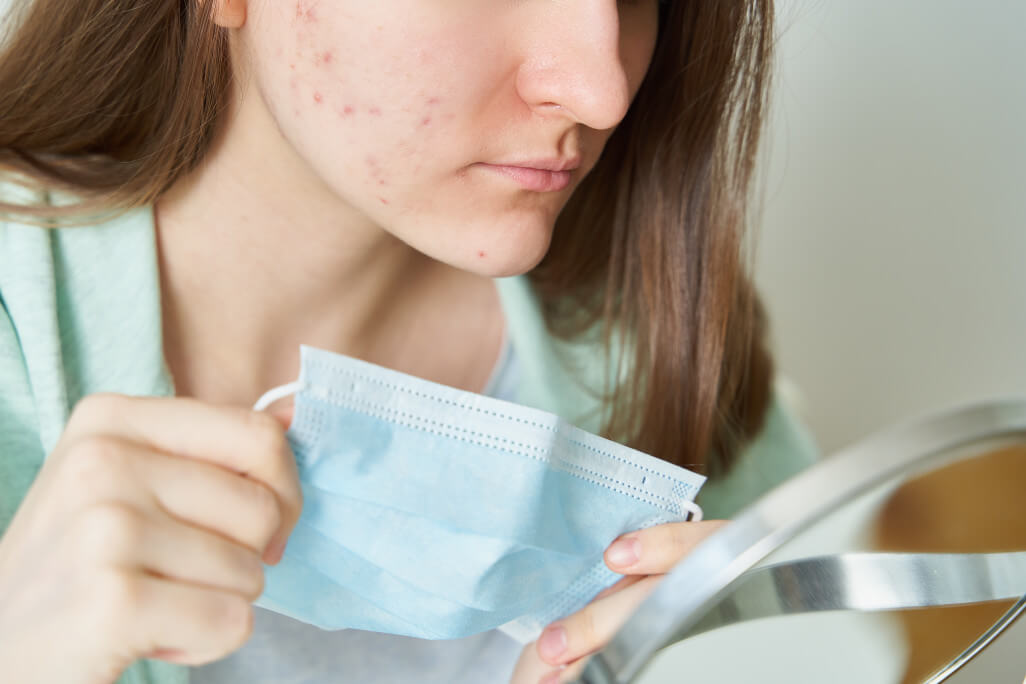 Faceless woman having pimples and blackheads after-wearing protective medical mask landscape