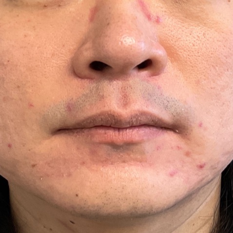 Before & Afters - Courtesy of James Wang, MD